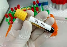 Blood Tonic pour la purification du sang, �limine le mauvais cholest�rol, normalise la pression art�rielle, r�gule le rythme cardiaque, etc.