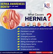 A hernia usually occurs in the abdomen or groin, when one of the organs pushes through the muscle or tissue that contains it. Hernia cure is a natural solution made of plants to preven