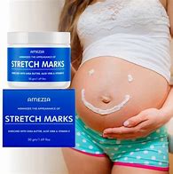 100% Effective Snails Stretch Marks Repair Cream 300g, pregnancy stretch marks cream prevent and remove stretch marks. Snail Stretch Marks Repair cream contains snail extract, nourishe