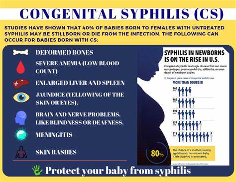 Syphilis is a STI that can cause serious health problems if not treated. Syphilis Cure is a 100% natural solution to fight against Syphilis